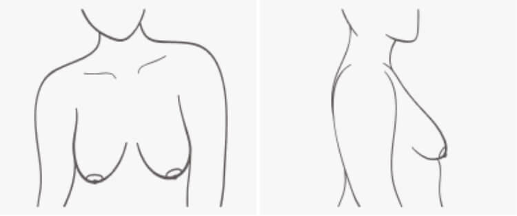 Bra Fit Issues