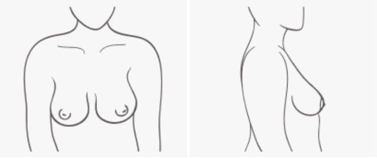 Bra Fit Issues