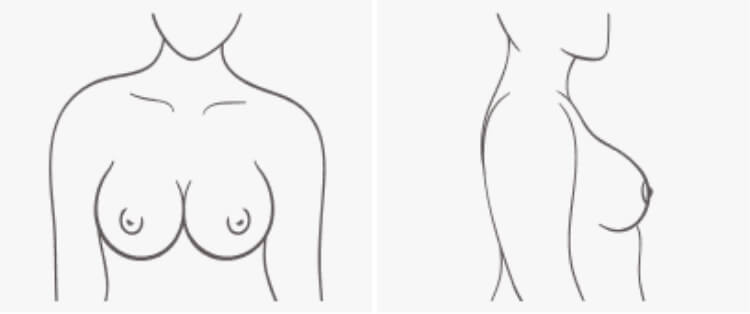 Bra Fit Issues